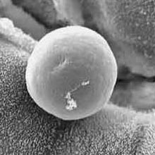 Microscopic view of contaminant